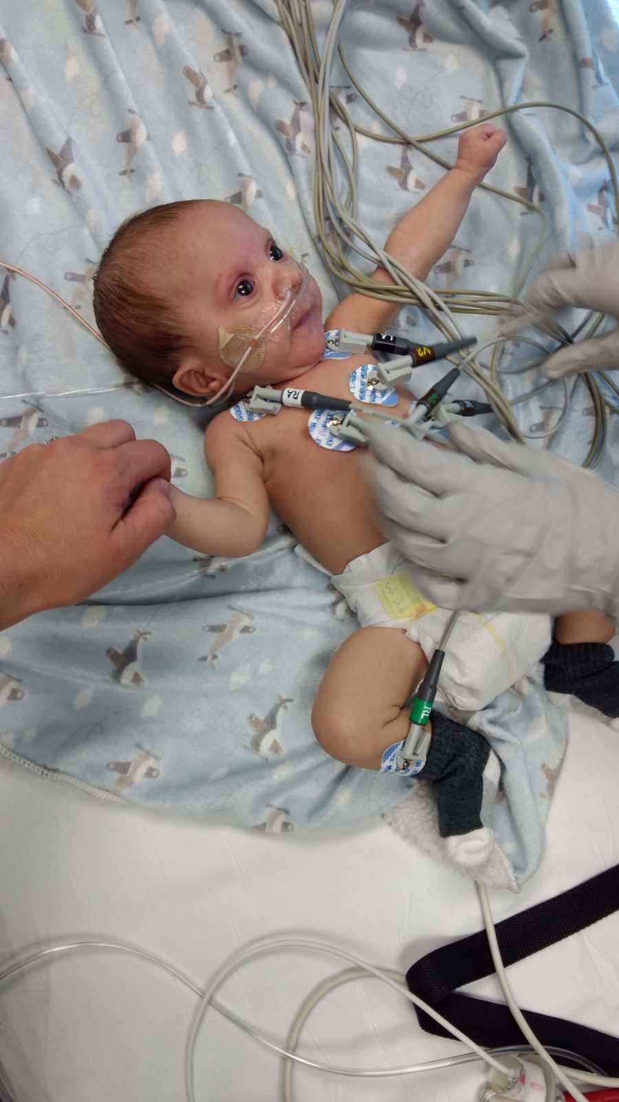 Newborn with unknown disease lays on back in NICU connected to monitors