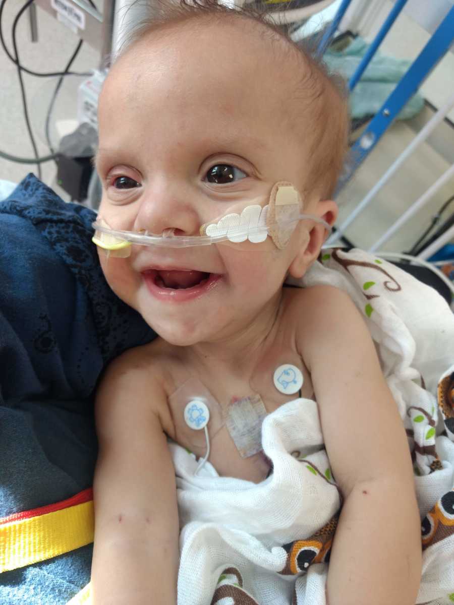 Baby with pace maker smiles as he is connected to monitors and has tube up his nose