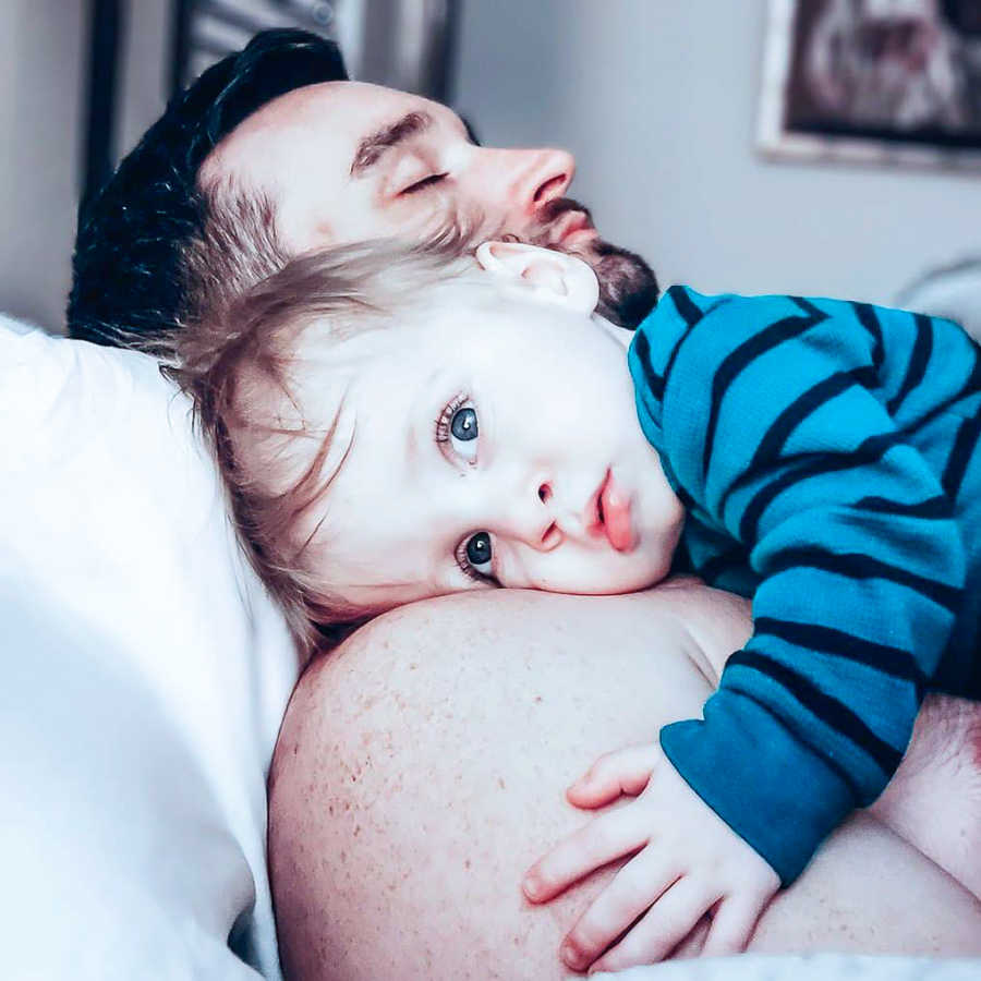 Baby boy with dwarfism lays on chest of sleeping father