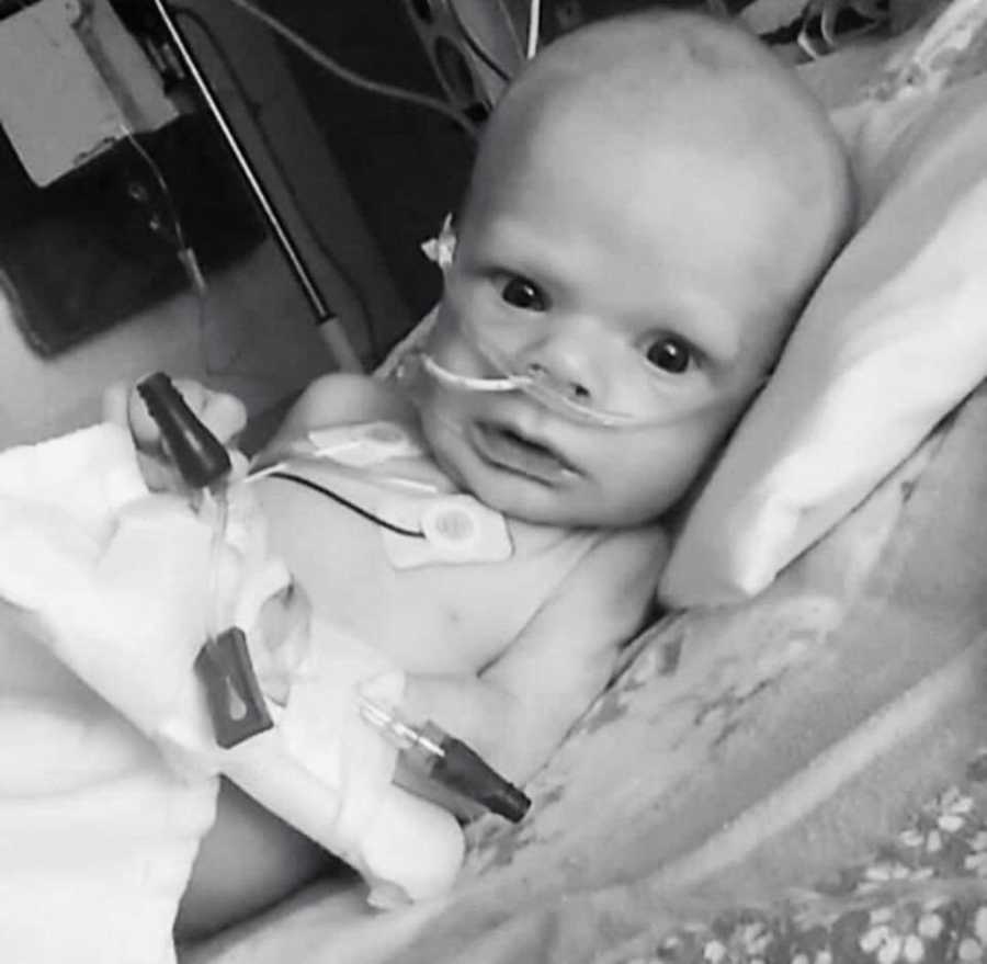 Newborn with brain cancer lays in NICU with tubes up his nose