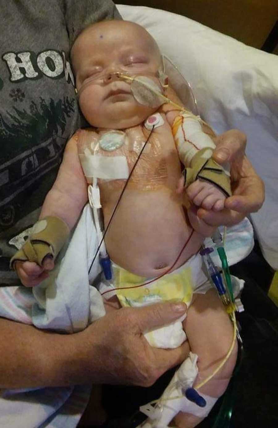 Newborn with brain cancer lays in adult's arms as he is hooked up to monitor's