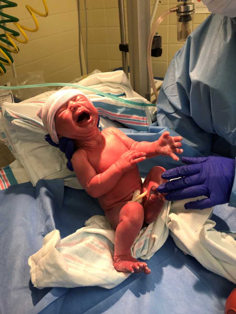 Nurse holds newborn with Ichthyosis who is crying 