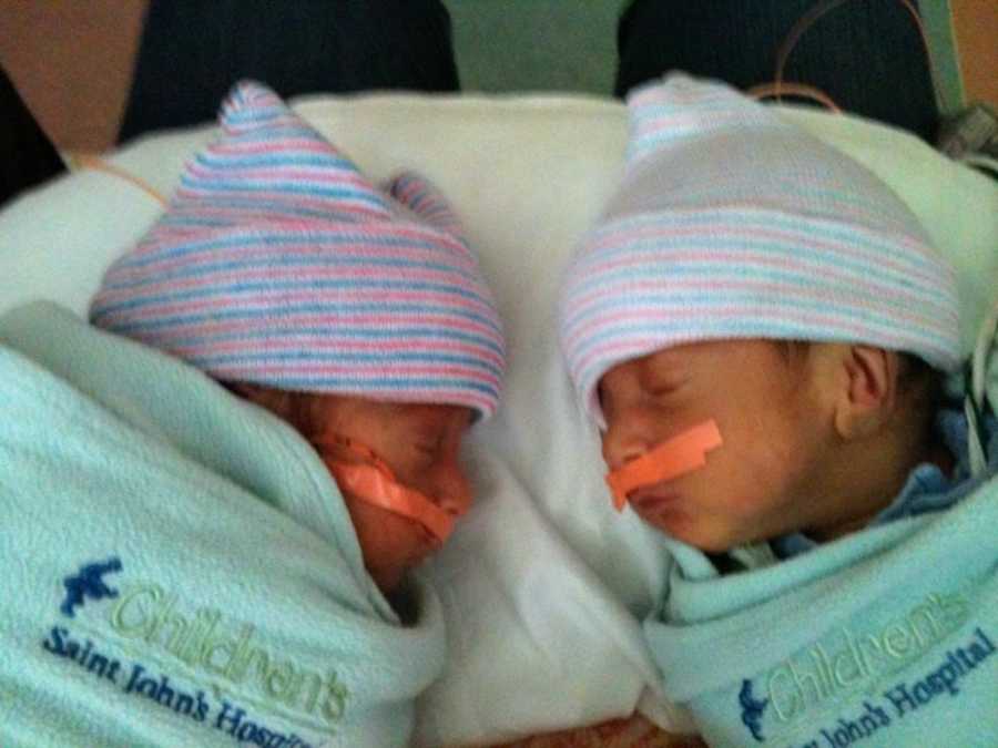 Newborn twins with cerebral palsy lay asleep swaddled in blankets