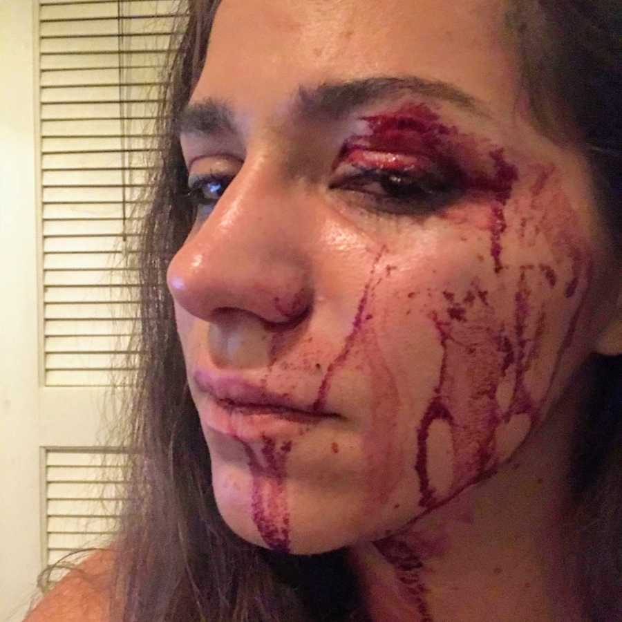 Side of woman's face that is bloody after boyfriend hit her
