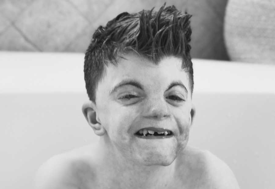 Little boy with Cornelia de Lange Syndrome sits smiling in bath tub with hair spiked up