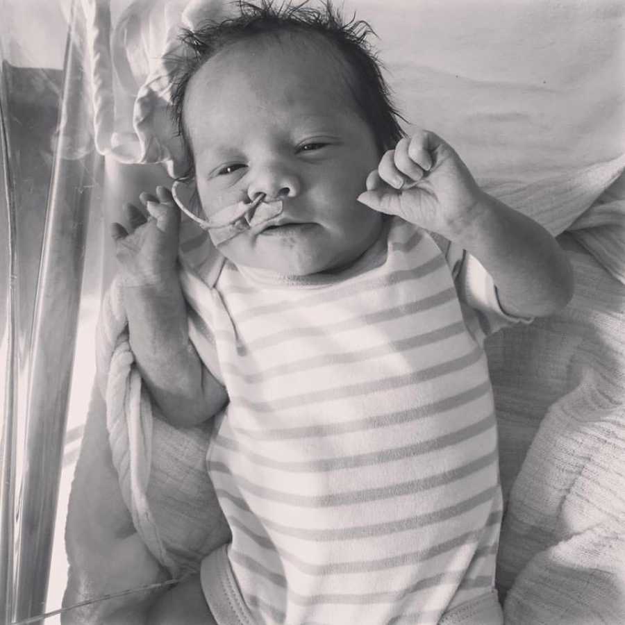 Baby lays on back in NICU with tube up her nose