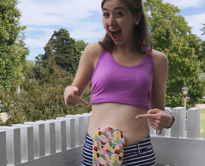 Woman with ostomy bag stands smiling outside with shirt raised pointing at her bag