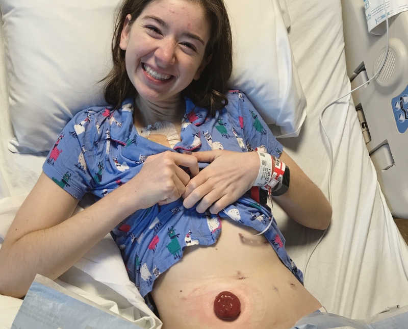 Woman lays smiling in hospital bed holing up shirt to expose her ostomy