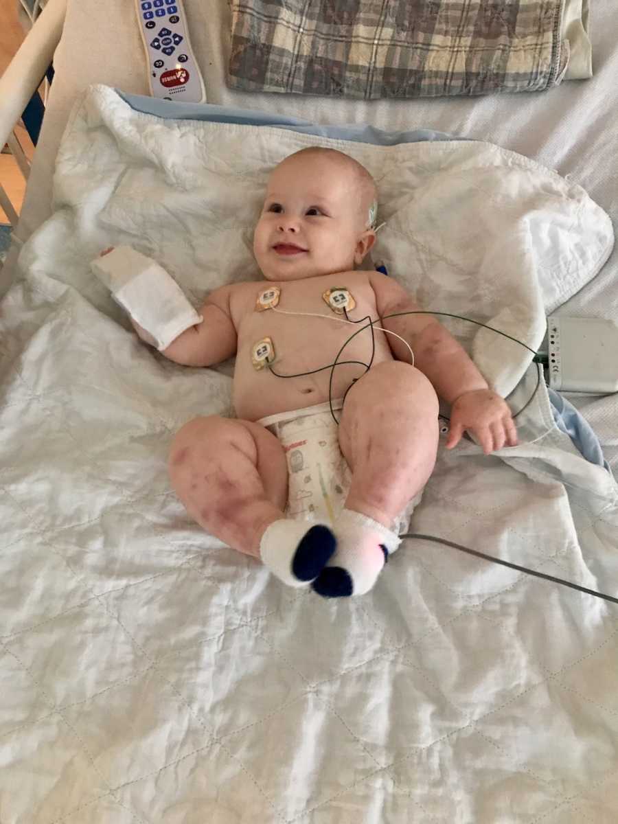 Baby with acute lymphoblastic leukemia lays on back in PICU smiling