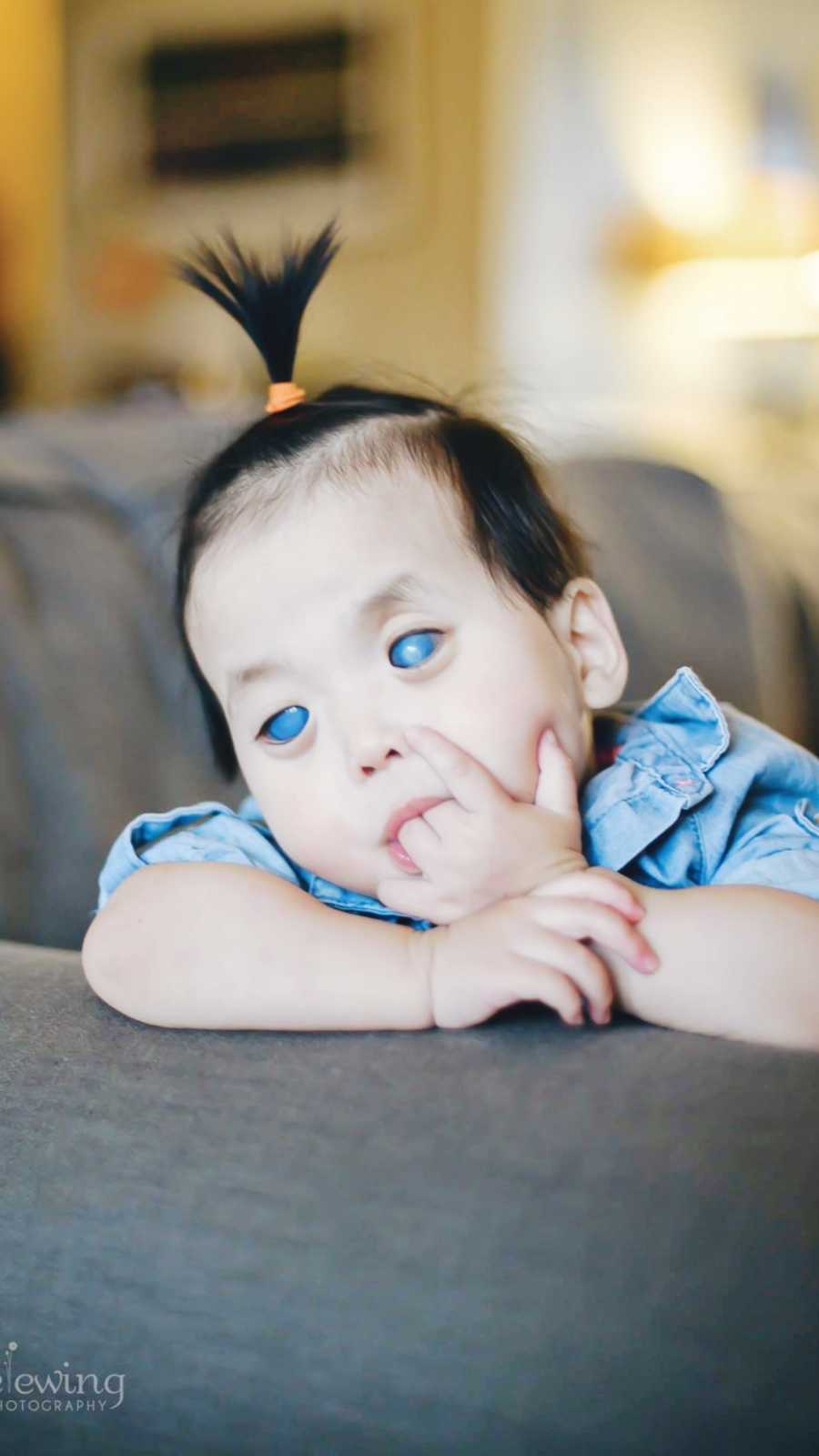 Close up of deaf and blind baby who has he hand in her mouth