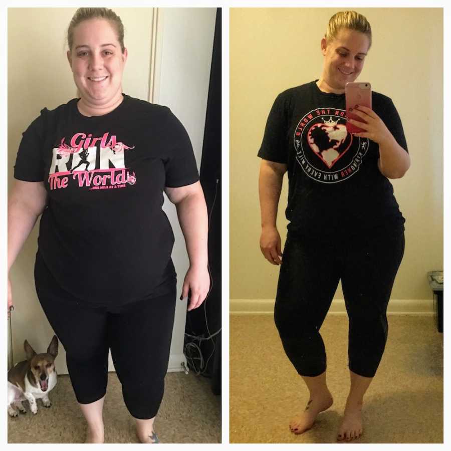 Side by side of woman with Crohn’s Disease before and after losing weight