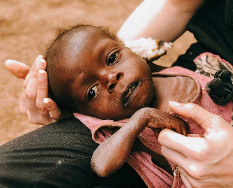 Malnourished little girl lays on her back in woman's lap holding her hand