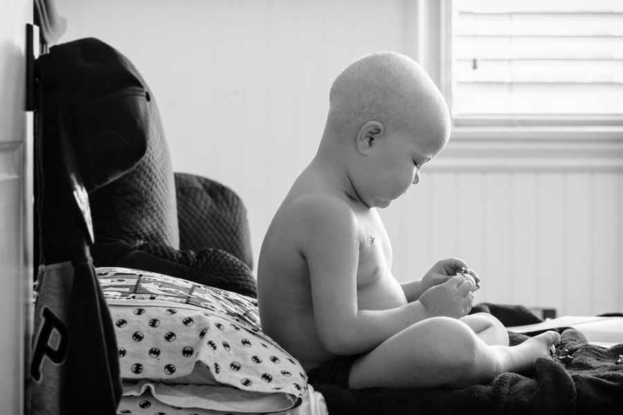 Little boy with cancer sits in bed without shirt on