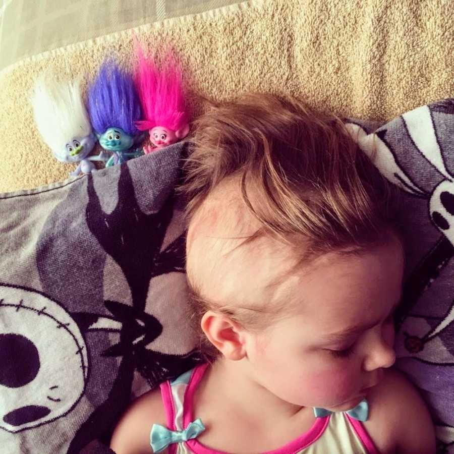 Little girl who has finished chemo lays on towel with three troll toys beside her