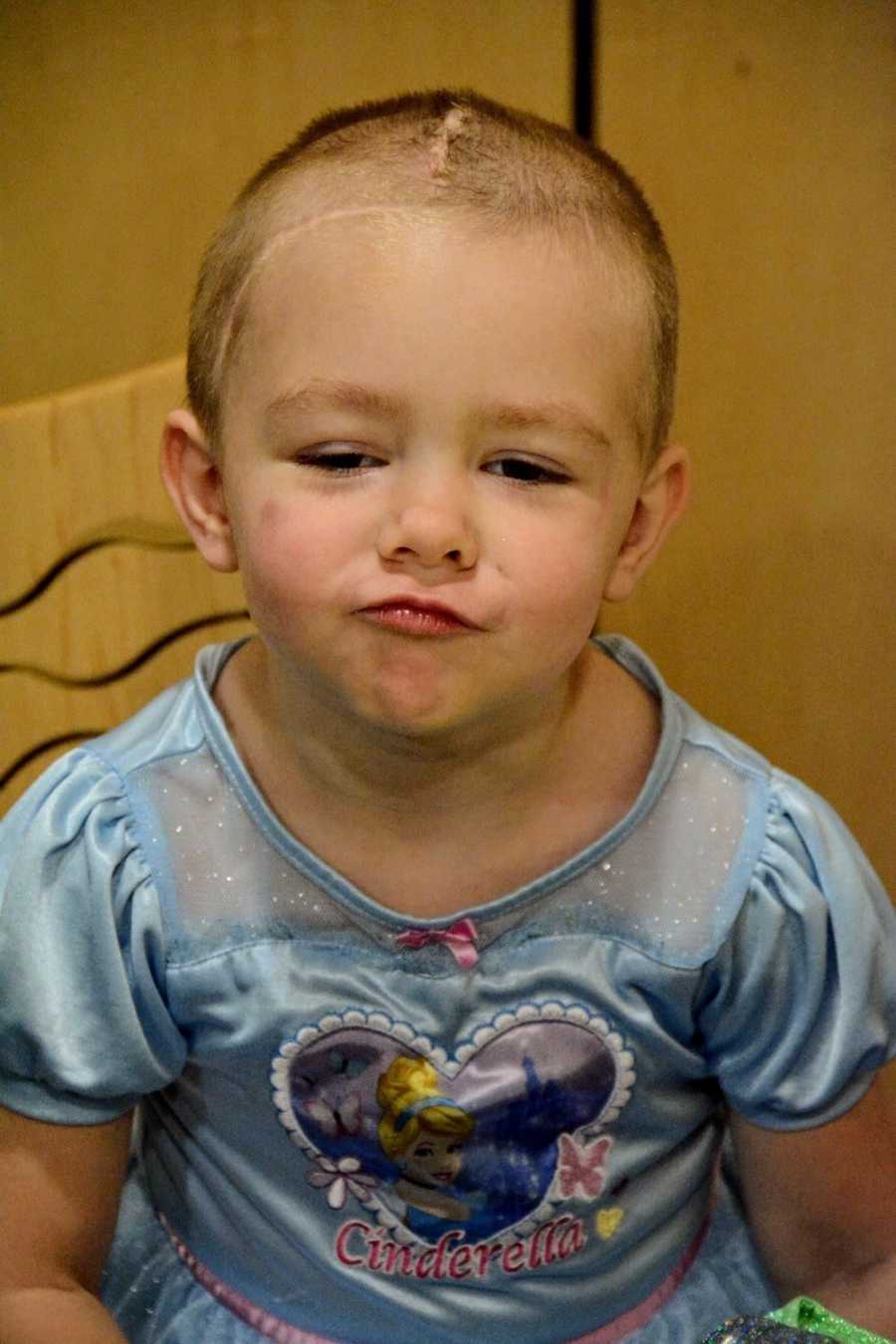 Little girl who has finished chemo sits in princess dress making pouty face