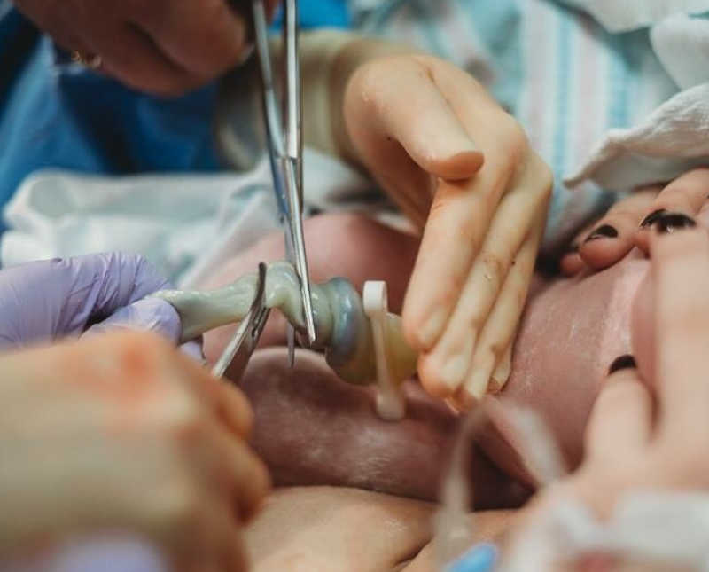 Close up of father cutting umbilical chord before newborn passes away