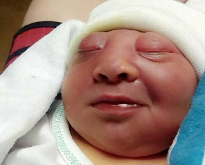 Close up of newborn's face who won't survive and will go to surgery to donate organs