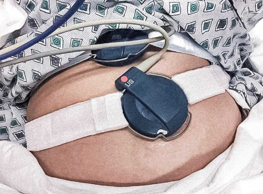 Birthing band on pregnant woman's stomach