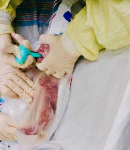 Nurses tend to small baby before taking her to NICU