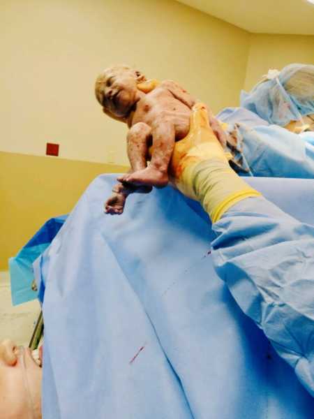 Doctor holds bloody newborn baby in air