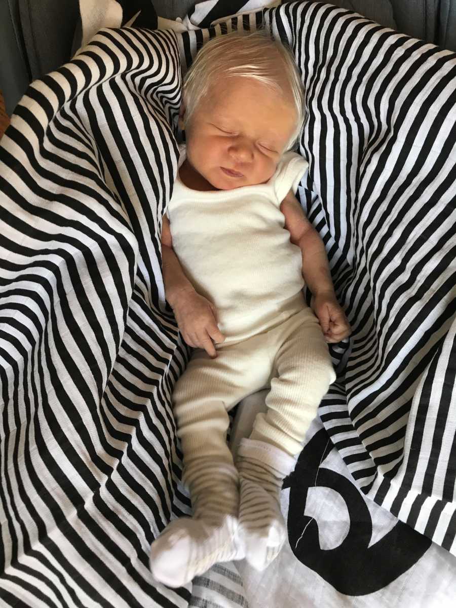 Albino baby lays asleep on black and white stripe blanket