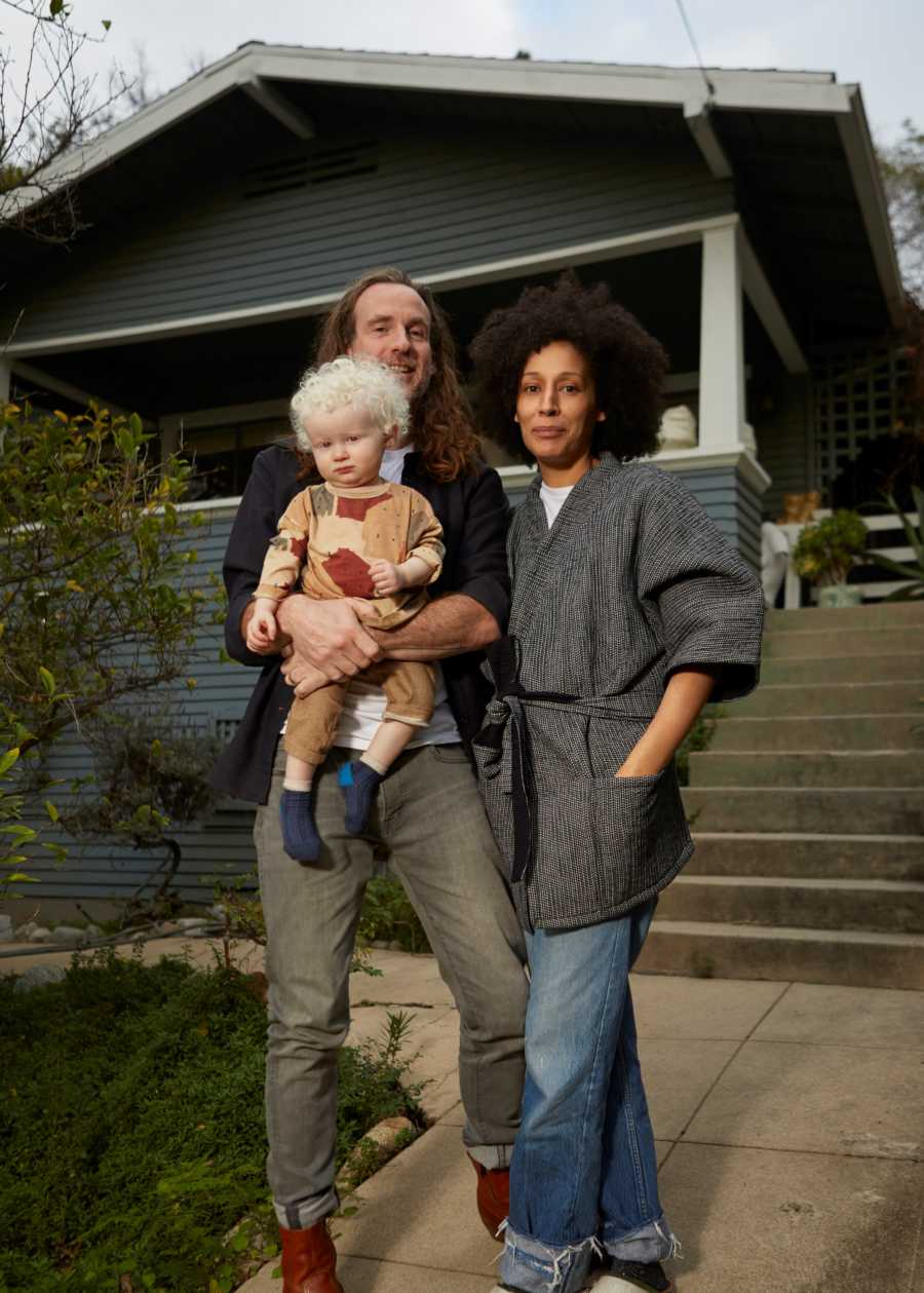 Husband stands outside holding albino son beside wife