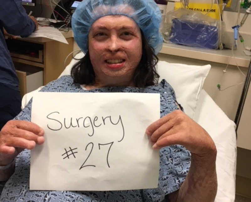 Man who works for US forest service sits in hospital bed holding sign that says, "surgery #27"