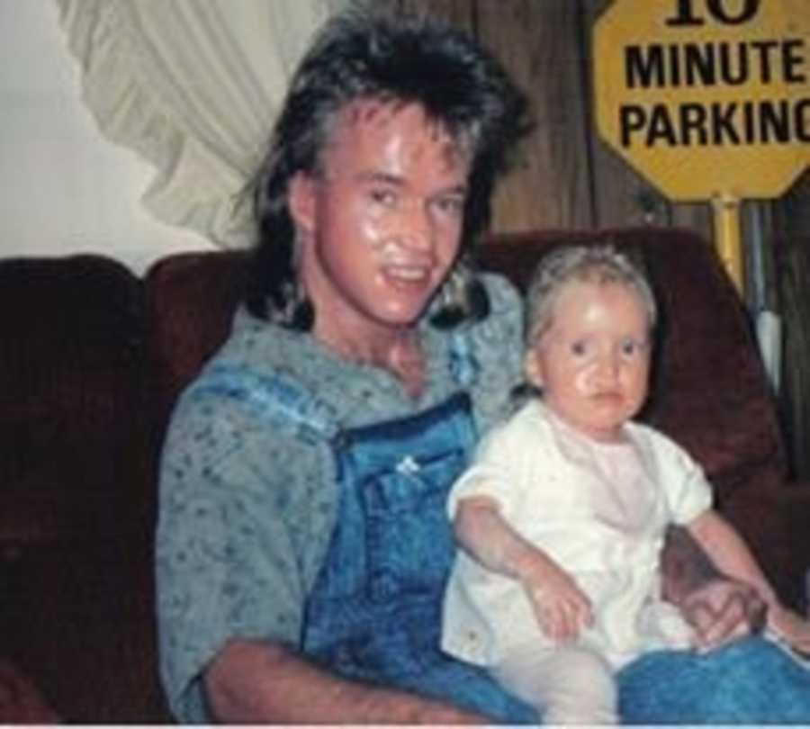 Father with Ichthyosis sitting on couch with baby in his lap