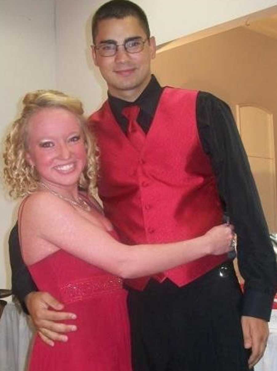 Young woman with Ichthyosis stands in formal wear with arms around young man