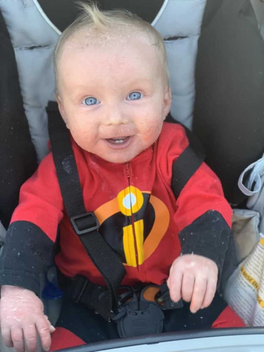 Baby with Ichthyosis sits in stroller wearing Incredibles onesie