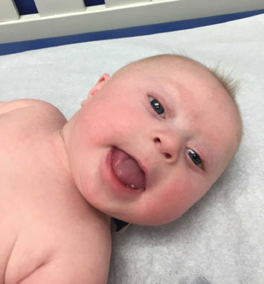 Close up of newborn with down syndrome laying on back with mouth open