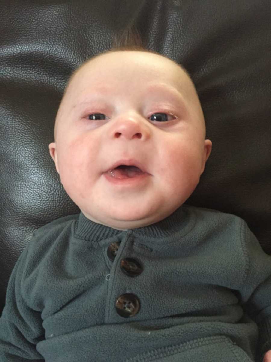 Baby boy with down syndrome lays on back with mouth open