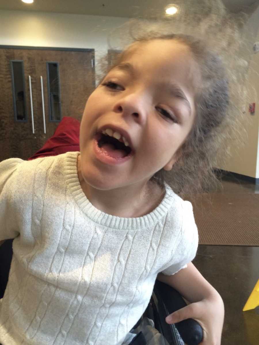 Little girl with special needs and in foster care sits with mouth open