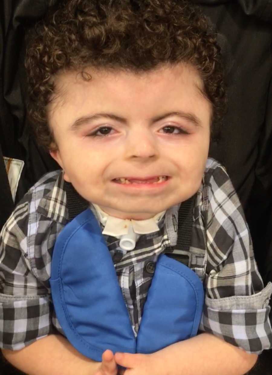 Boy with Cornelia de Lange Syndrome smiling as he sits in stroller