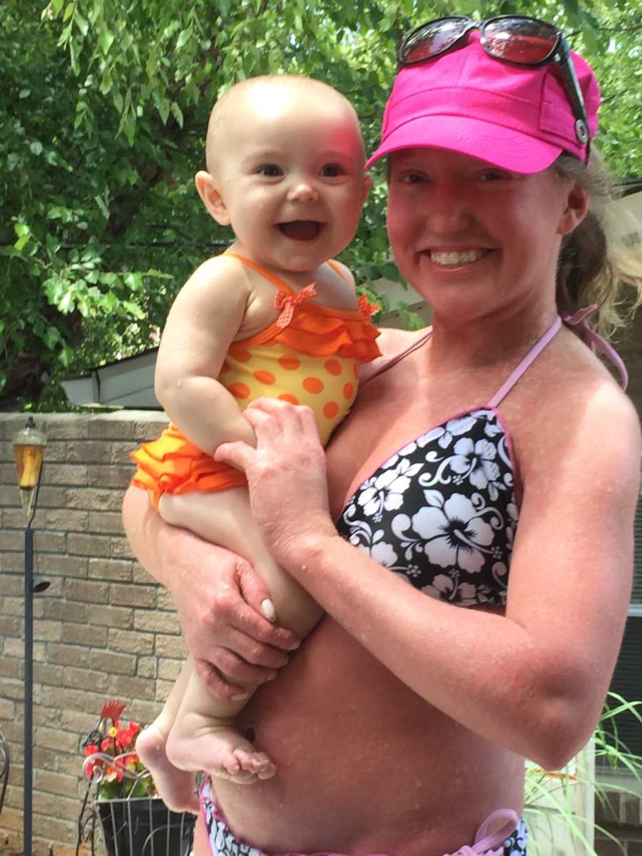 Mother with Ichthyosis stands in bathing suit outside holding baby girl in bathing suit