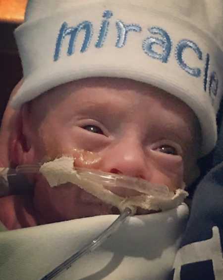 Close up of newborn in NICU whose mother was an addict