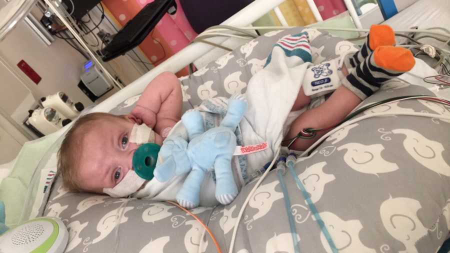 Baby with Hypoplastic Left Heart Syndrome lays in hospital with pacifier in his mouth