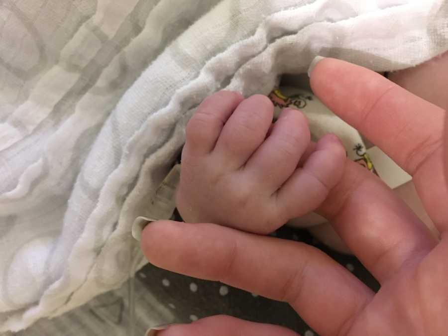 Baby with Hypoplastic Left Heart Syndrome holds mothers finger