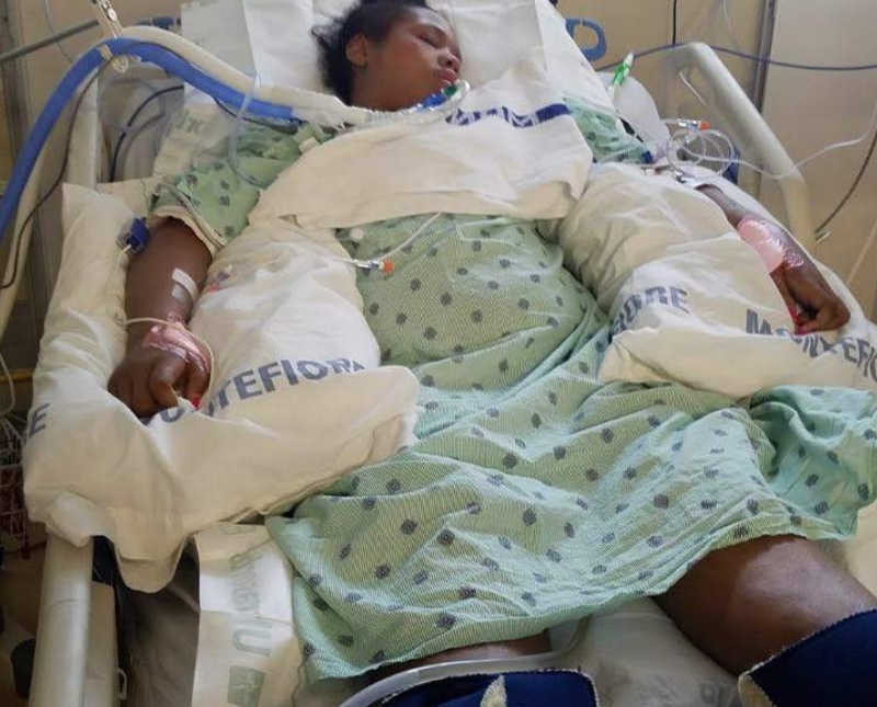 Intubated young woman lays in hospital bed in full paralysis