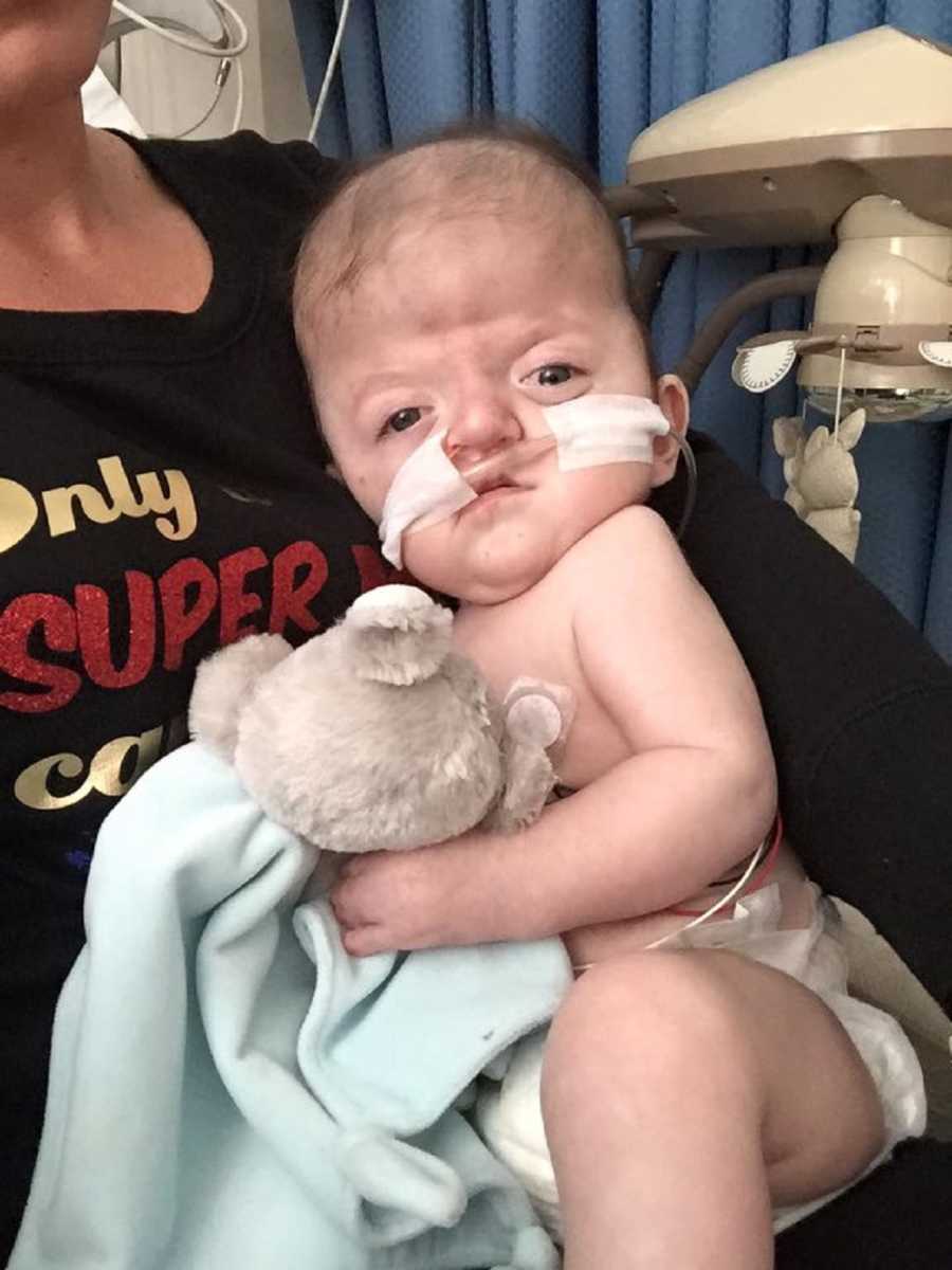 Intubated baby boy with Apert syndrome sits in lap of mother as he holds blanket and stuffed animal