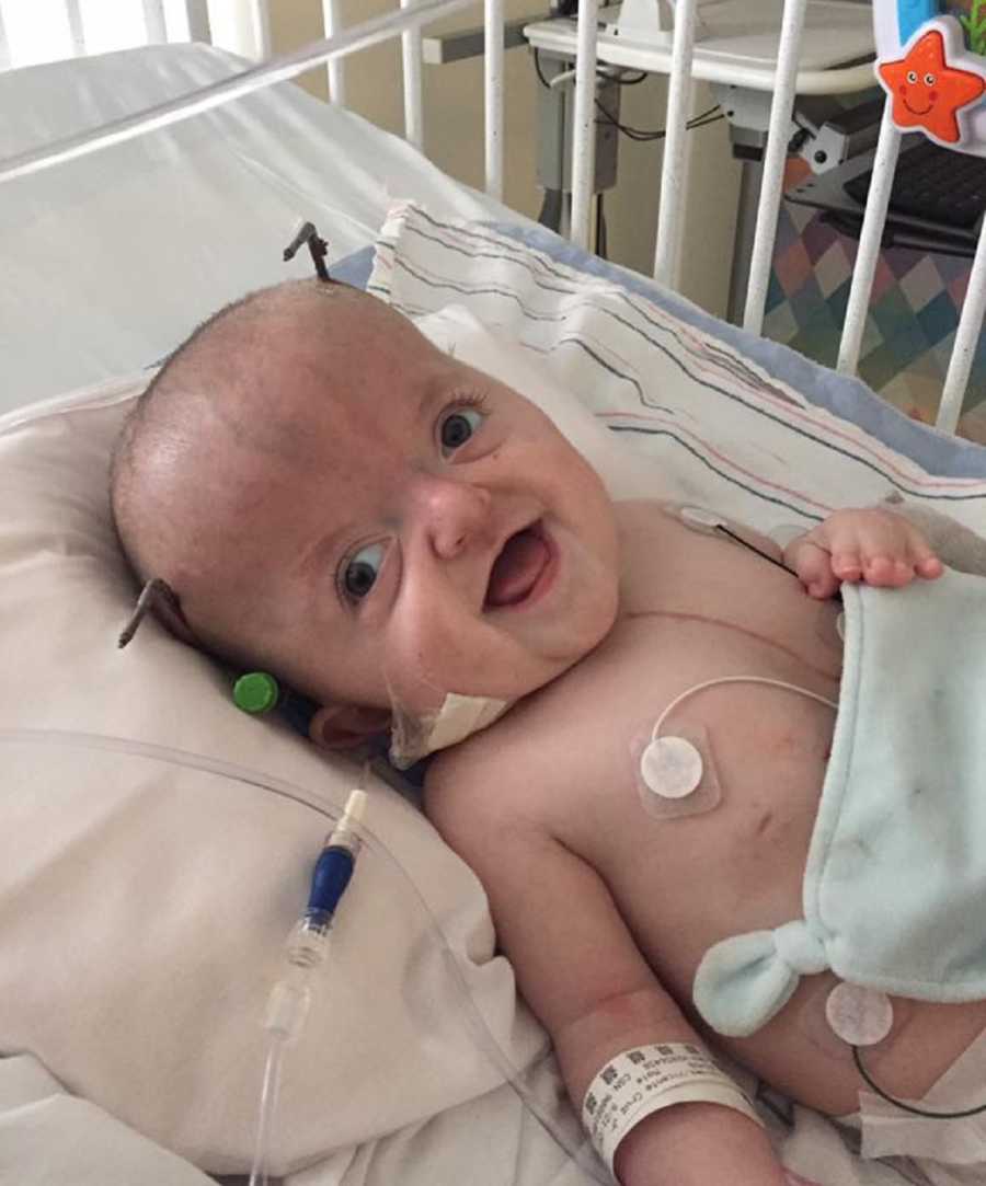 Baby boy with Apert syndrome lays on back smiling in hospital bed