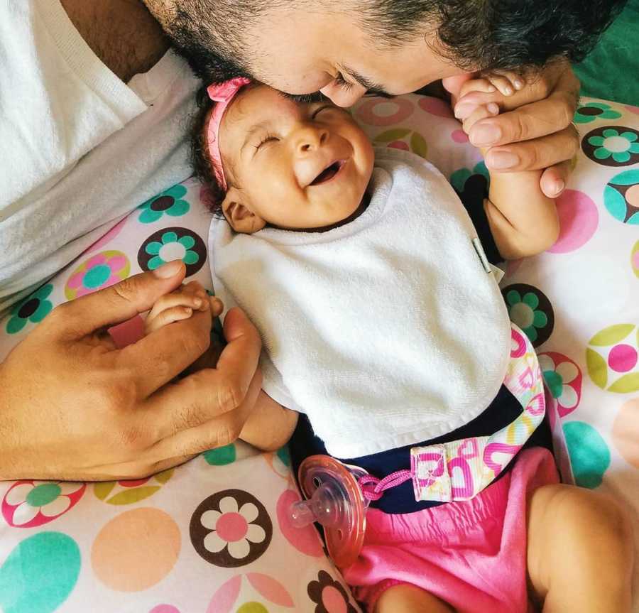 Father leans over to kiss baby on forehead who has anophthalmia