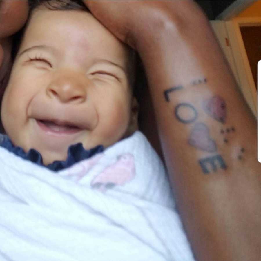 Blind baby without eyes smile while mother holds her head