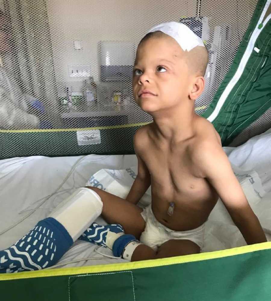Little boy with Williams Syndrome sits in hospital bed with bandage on top of his head