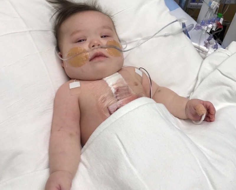 Baby with down syndrome lays in hospital bed after surgery