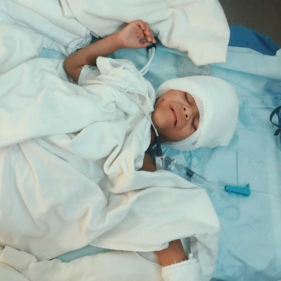 Little boy with Williams Syndrome lays on back in hospital bed with bandages wrapped around his head