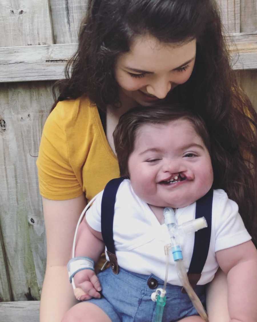 Baby boy with cleft palate and lip smiles as he sits on mothers lap