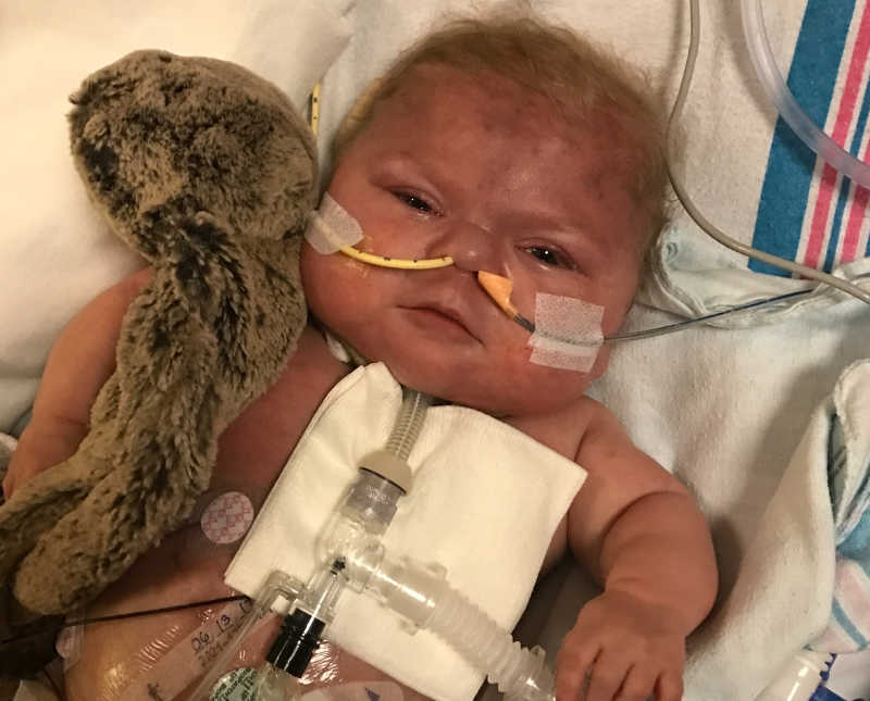 Baby with breathing tube lays on her back awake with stuffed animal at her side
