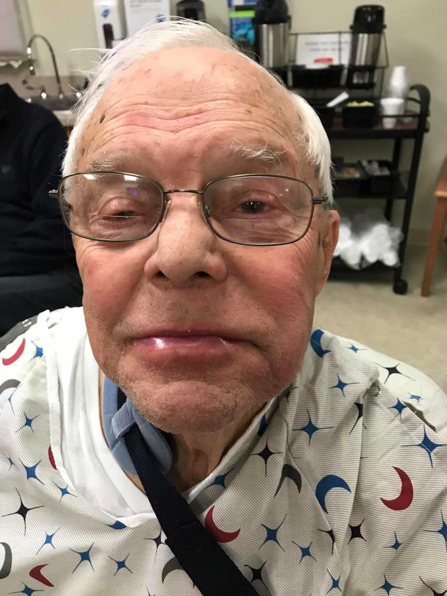 Man who was allergic to his blood pressure medication sits in hospital smiling