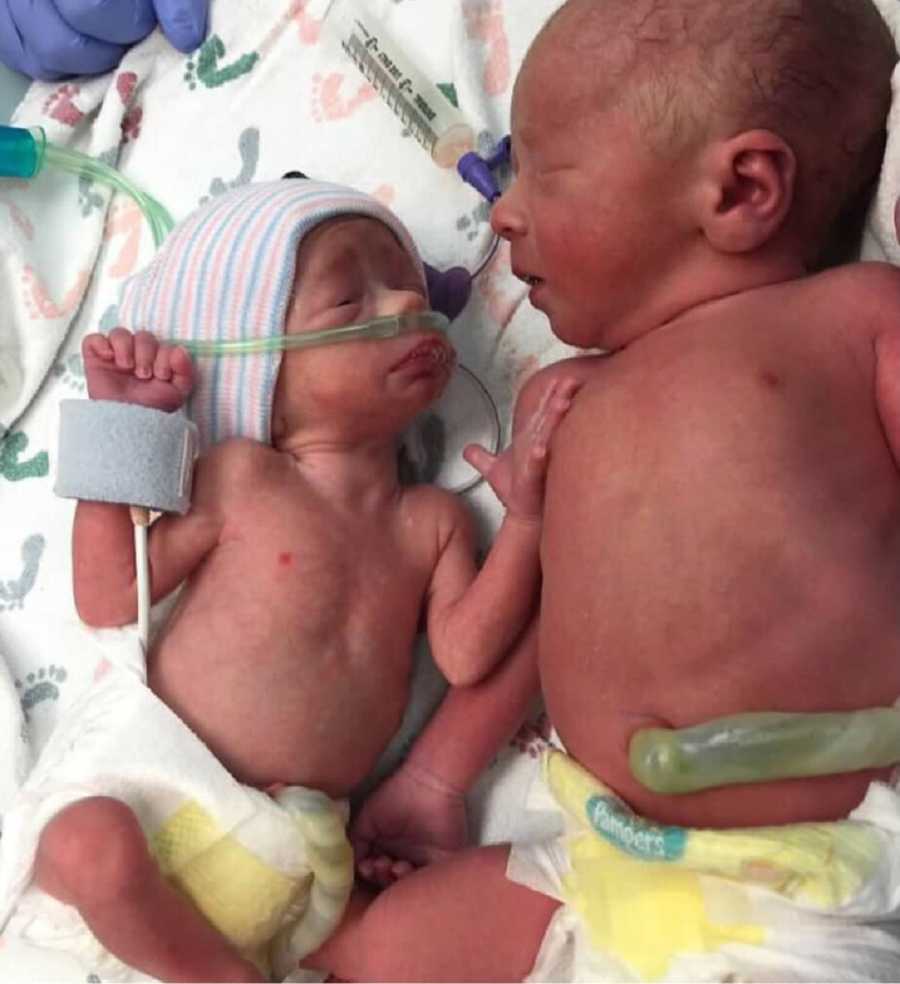 Intubated newborn lays beside twin who is much bigger